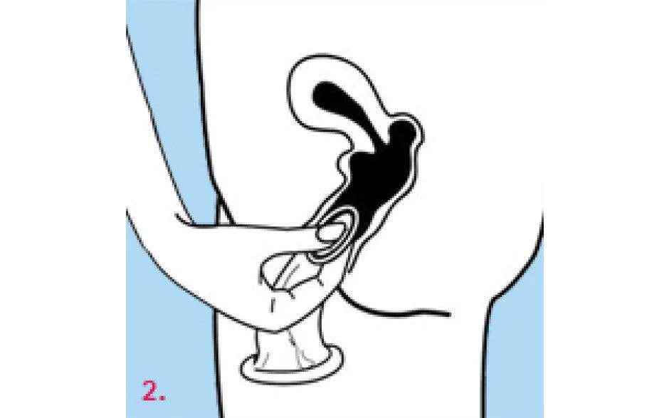 Femidom - 3 pack - Image 6