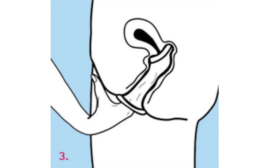 Femidom - 3 pack - Image 7
